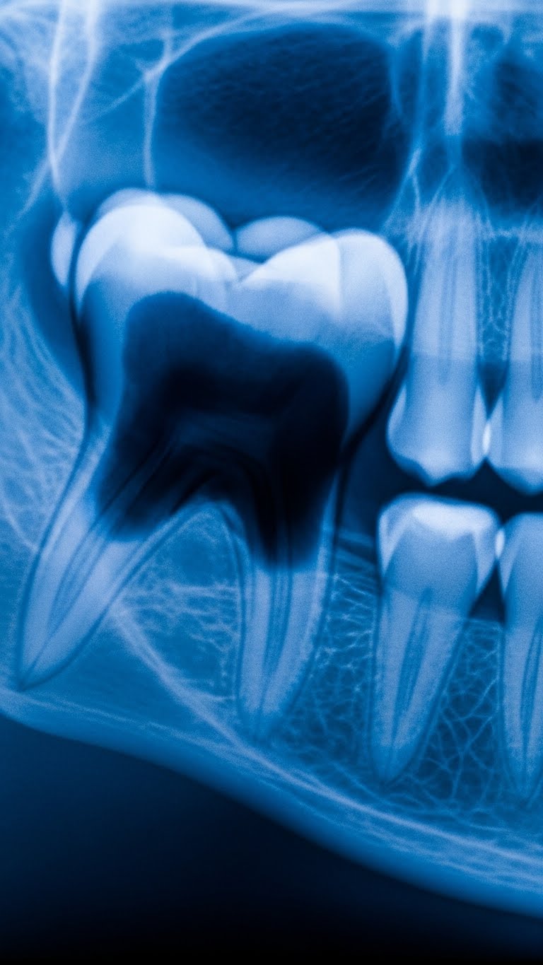 Patient feeling relieved